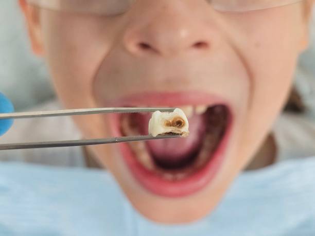 Best 24-Hour Emergency Dentist in Mcconnellstown, PA