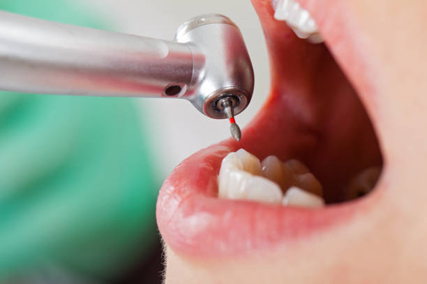 Best Emergency TMJ Treatment in Mcconnellstown, PA